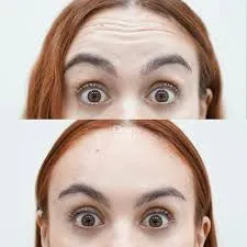 Tratamientos faciales hoy: criterio, prevención y armonía consciente